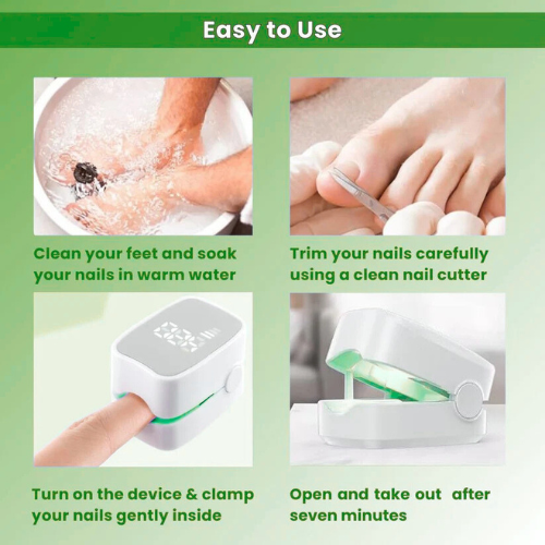 Homzgear™ - Nail Fungus Laser