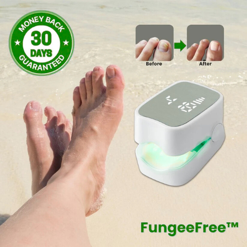 Homzgear™ - Nail Fungus Laser